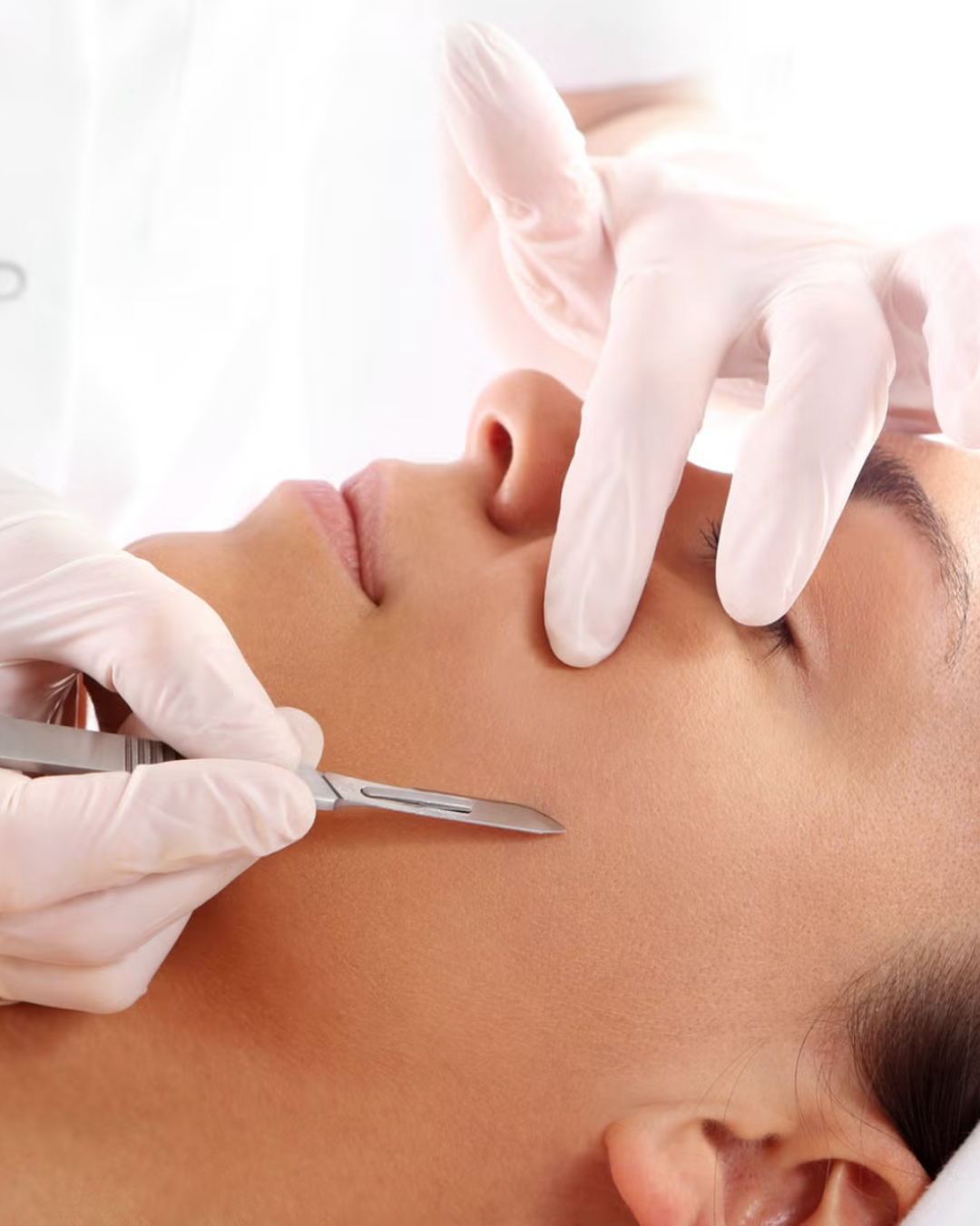 DERMAPLANING FACIAL